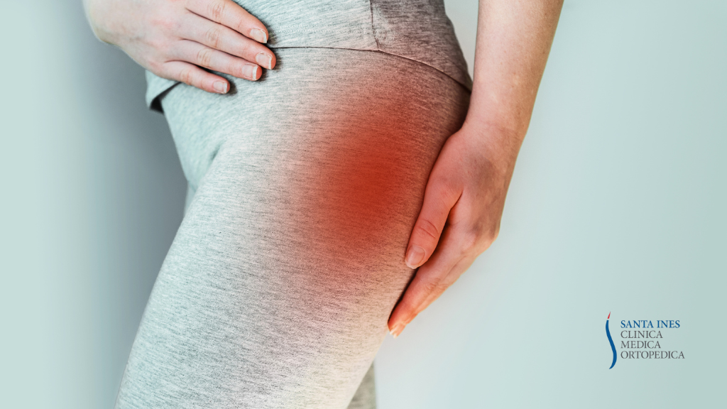 Sindrome del Piriforme: La Gestione Riabilitativa