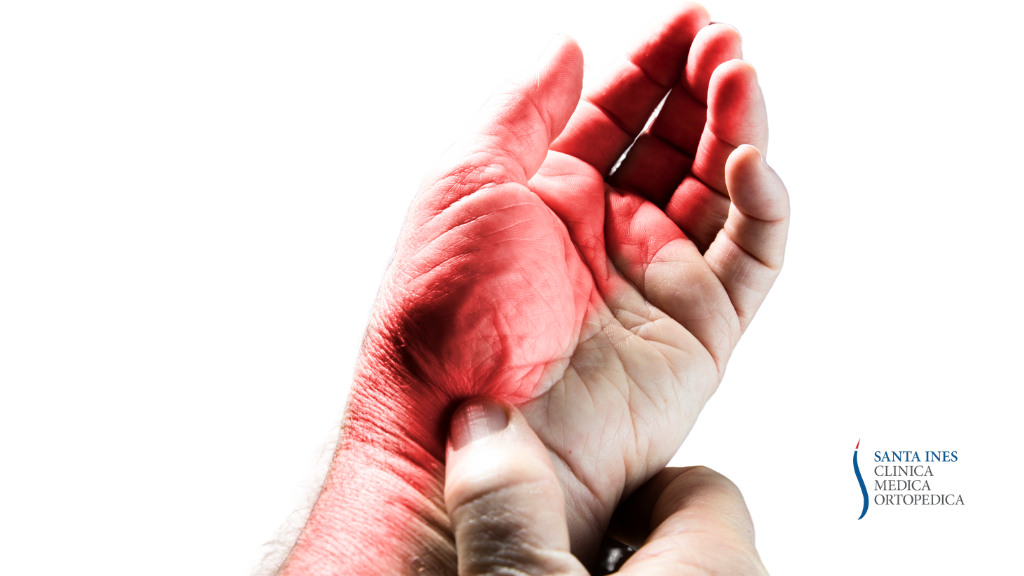 Sindrome del Tunnel Carpale: Cause e Trattamenti